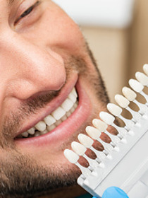 Types Of Veneers For Your Teeth: Cost, Procedure, And Results