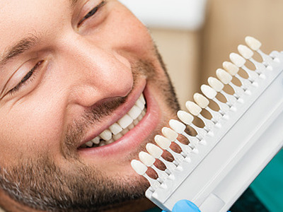 Types Of Veneers For Your Teeth: Cost, Procedure, And Results